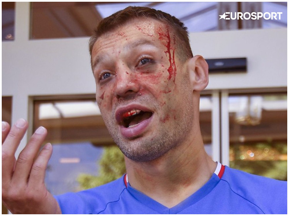 UFC Березуцкий