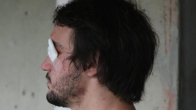 Cazenave : « Mon handicap ne doit plus être perçu comme tel »
