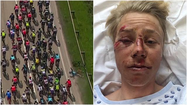 Slik så Valgren ut etter skrekkvelten: – Jeg vet ikke hva som skjedde