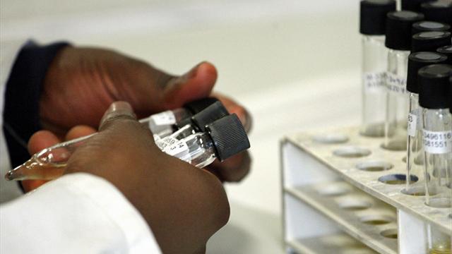 Fragen und Antworten zur Dopingstudie der Uni Tübingen