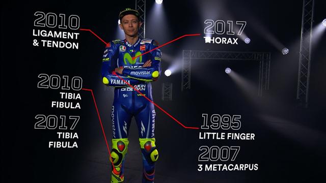 Die Verletzungen des Doktors: Das hat sich Rossi schon alles gebrochen Die Verletzungen des Doktors: Das hat sich Rossi schon alles gebrochen