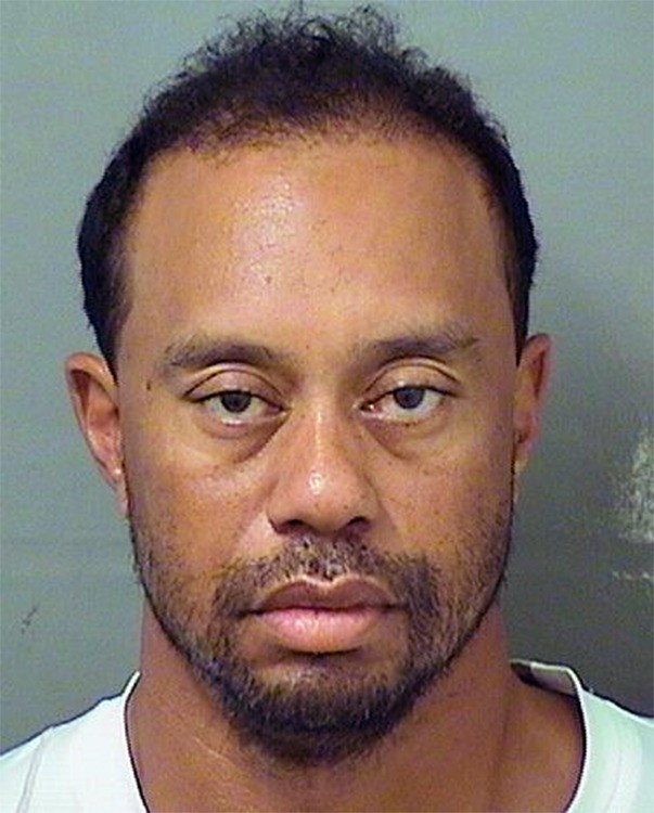 Tiger Woods en 2017 après son interpellation