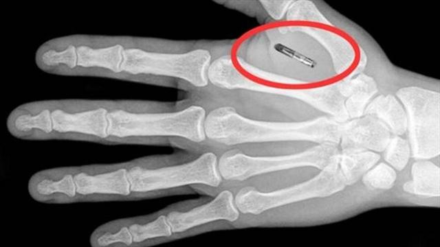 La proposta: microchip sotto la pelle degli atleti per combattere il doping