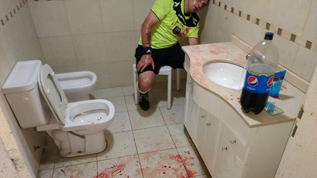 Кровавая фотка аргентинского судьи, которому фанаты пробили голову камнем