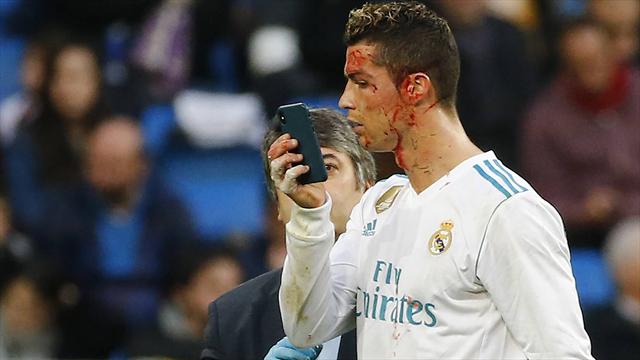 Selfie im Spiel? Blutiger Ronaldo irritiert mit kurioser Handy-Aktion
