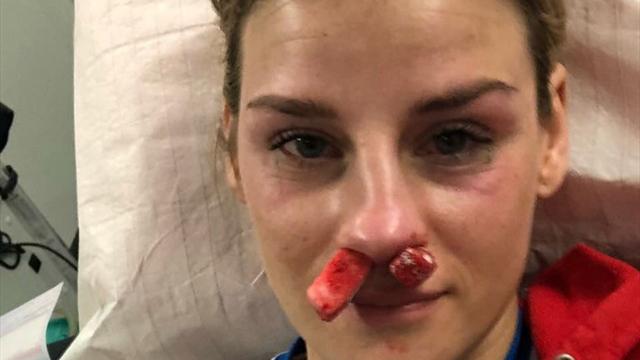 Голландская гандболистка вышла на площадку в день рождения и через 90 секунд сломала себе нос