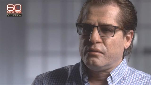 Родченков дал первое интервью после пластической операции. Ты его не узнаешь