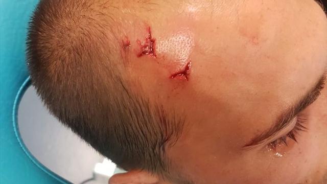 Sporting Lisbona: tifosi incappucciati aggrediscono staff e giocatori, 21 arresti