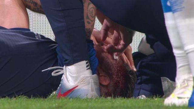 Un violent choc aérien, beaucoup de sang, et Giroud est sorti KO