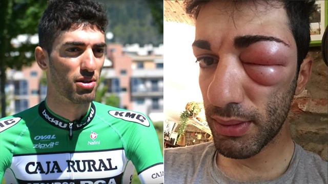 Danilo Celano shock: volto sfigurato per la puntura di un insetto, salta il Giro di Occitania