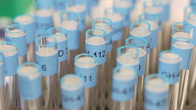 No positive doping tests at Russia 2018