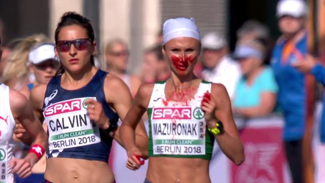 Runner suffers horrendous nosebleed during marathon in Berlin - before winning Runner suffers horrendous nosebleed during marathon in Berlin - before winning