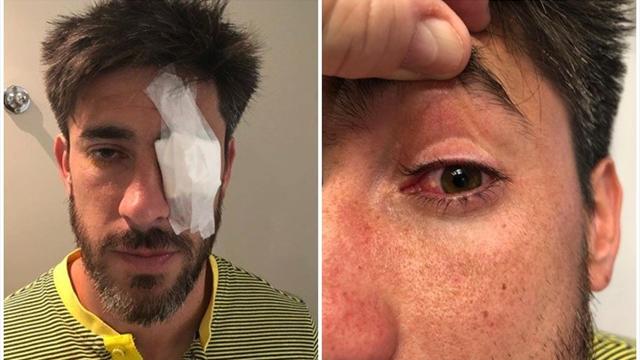 River-Boca, tutta la rabbia di Pablo Perez: "Se perdo l’occhio, non me lo restituisce nessuno"