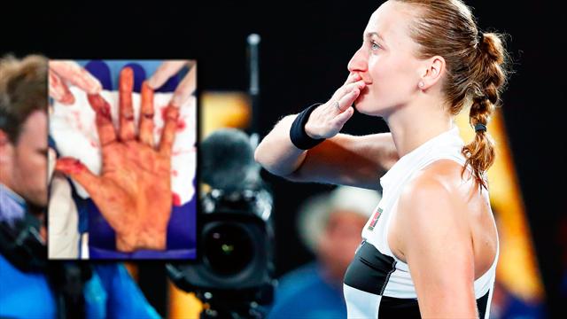 Das Kvitova-Märchen: Grand-Slam-Finale nach fieser Messerattacke Das Kvitova-Märchen: Grand-Slam-Finale nach fieser Messerattacke