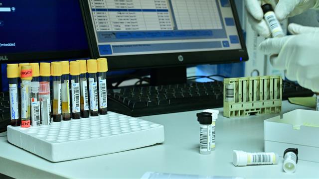 Nasce il computer per scoprire chi usa doping: progetto della WADA con intelligenza artificiale