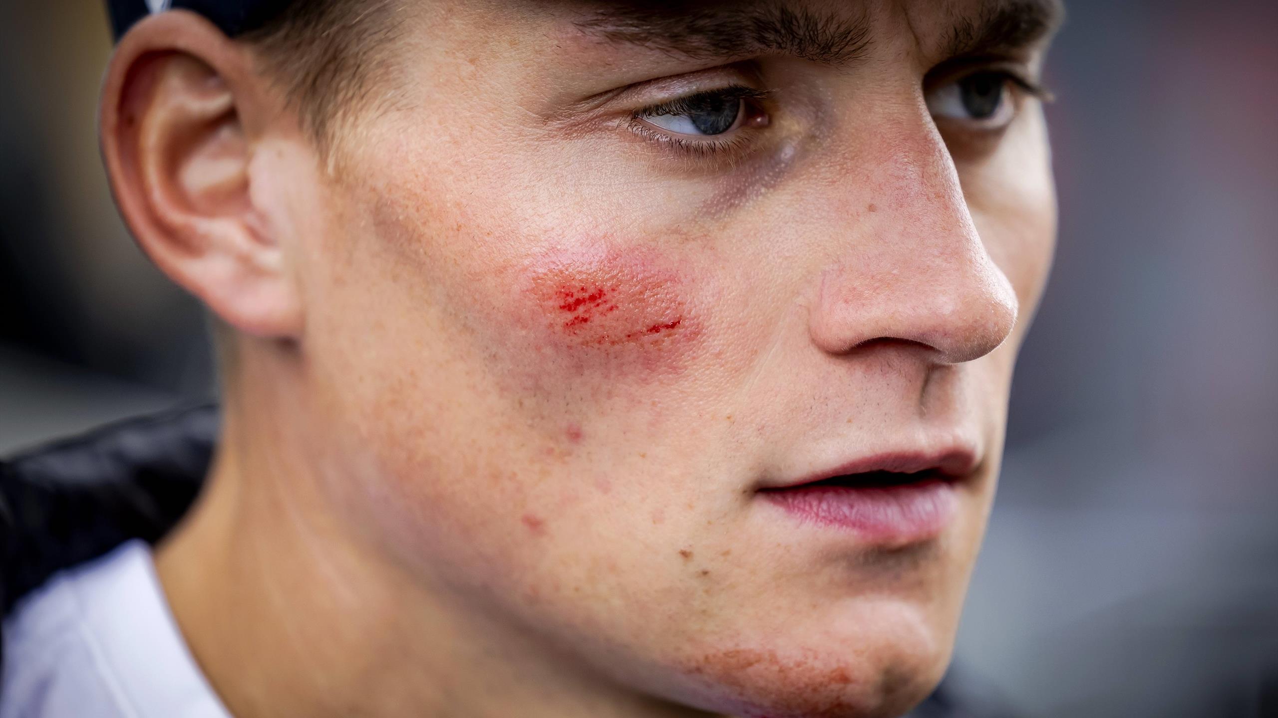 Rad-WM: Mathieu van der Poel hadert nach Sturz in Glasgow im Mountainbike  mit sich - Eurosport