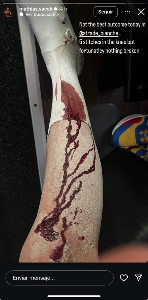 Así quedó la pierna de Mathias Vacek tras su caída en la Strade Bianche 2025
