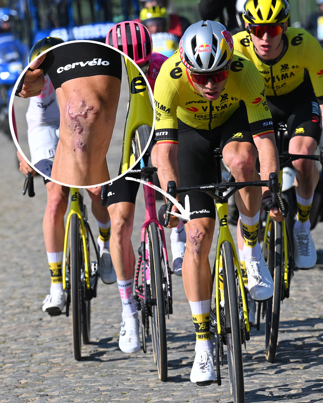 La impactante imagen de la rodilla de Van Aert en A Través de Flandes 2025